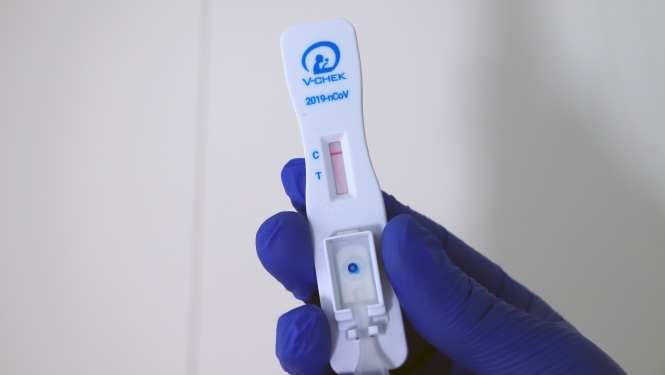 antigēna tests