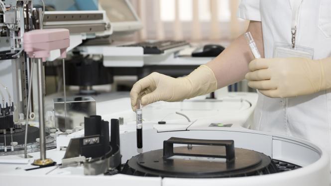 Laboratorijas izmeklējums