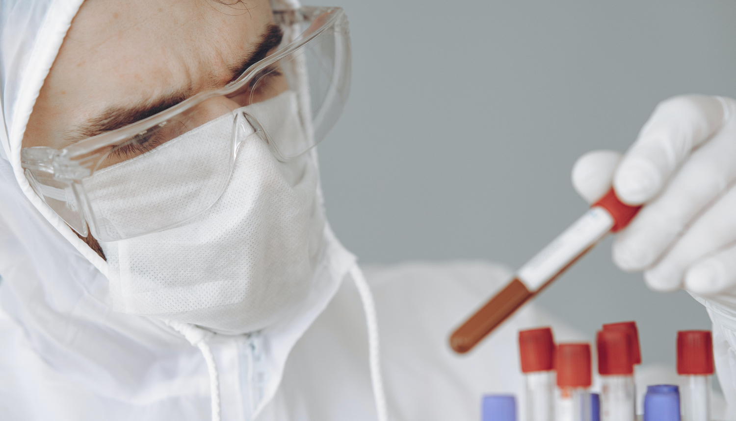 Laboratorijas izmeklējums