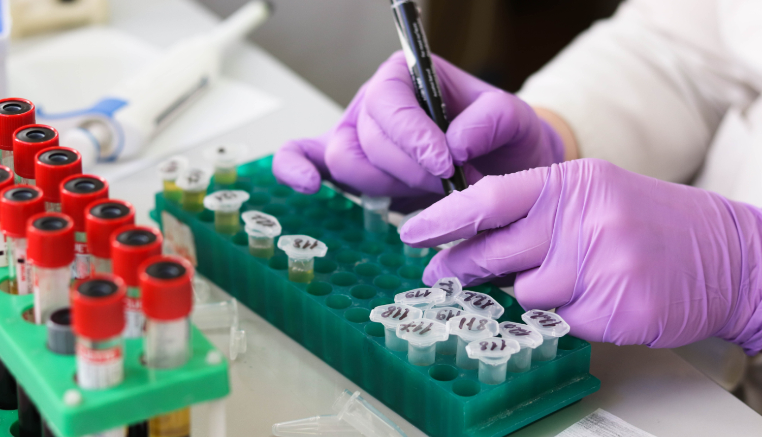 12. novembrī akcijā "Atklāj. Rīkojies!" visās "Centrālās laboratorijas" filiālēs bez maksas varēs nodot C hepatīta analīzes