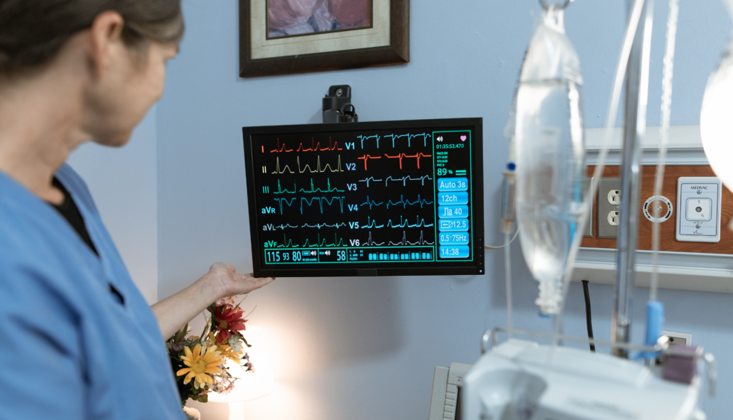 Monitors