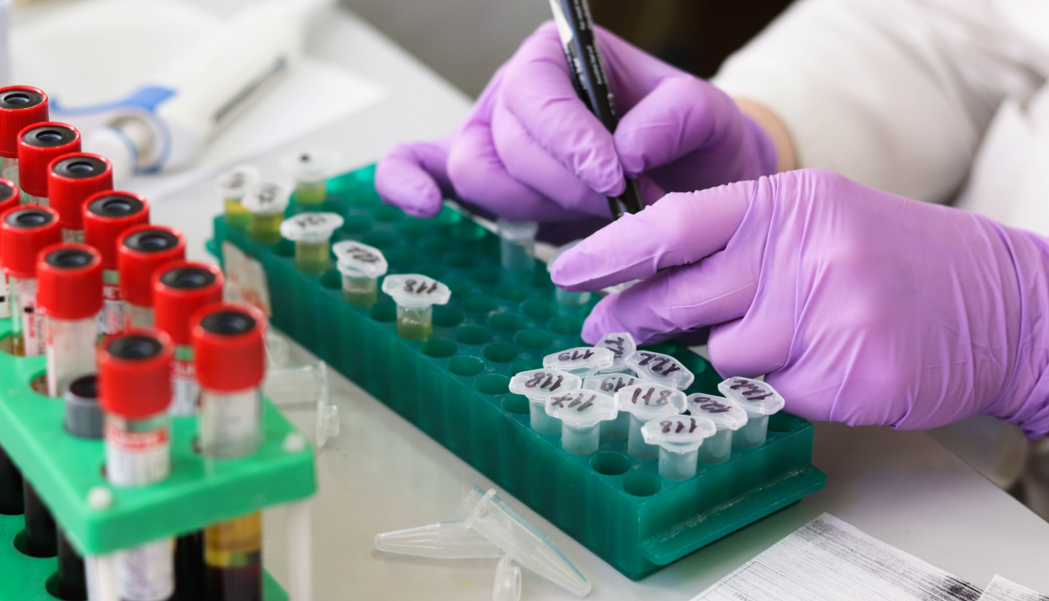 12. novembrī akcijā "Atklāj. Rīkojies!" visās "Centrālās laboratorijas" filiālēs bez maksas varēs nodot C hepatīta analīzes